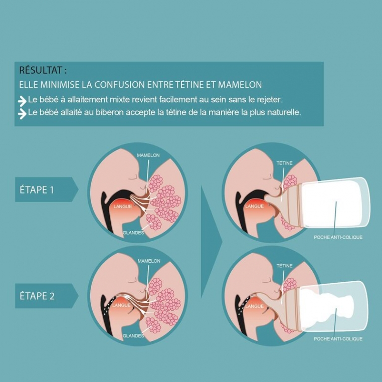 Lot De 2 Tétines Suavinex Zero Zero Débit Rapide (L) - Pour Liquides Épais - Silicone Ultra-Doux - +6 Mois